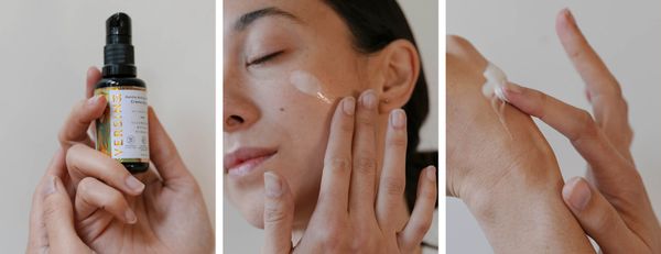 Điều trị nám - Thẩm mỹ Á Đông