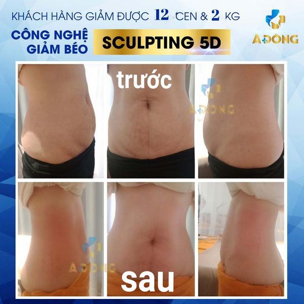 Giảm béo vẫn luôn là dịch vụ hot nhất của nhà Á Đông