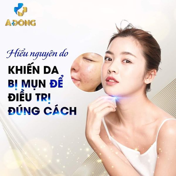 Trị Mụn Mãi Không Khỏi Là Do Bạn Chưa Tìm Hiểu Nguyên Nhân Bị Mụn !?