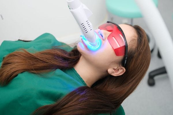 Tẩy trắng răng - Nha khoa Á Đông