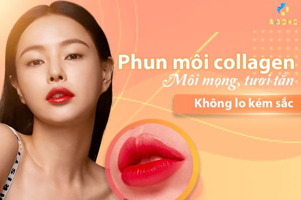Phun Môi Collagen