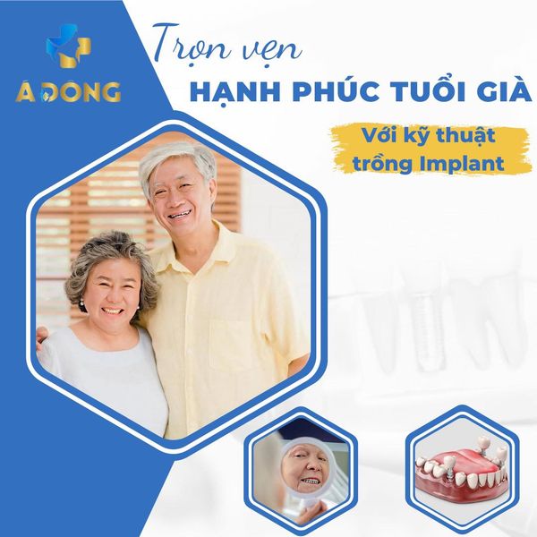 Trồng Răng Implant – Cứu Tinh Của Tuổi Già