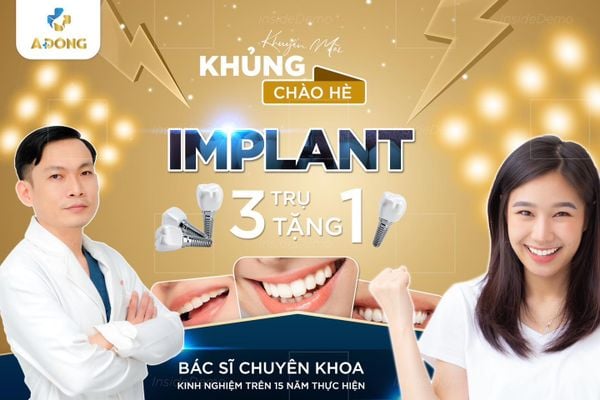 Khuyến mãi trồng răng Implant hè 2023 - Nha khoa Á Đông
