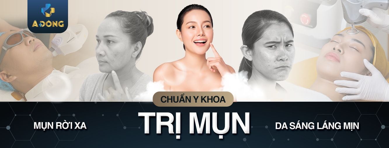 Trị mụn - Thẩm mỹ Á Đông