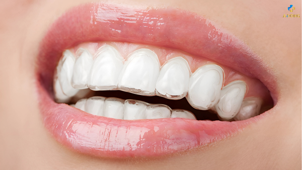Niềng răng invisalign – Giải pháp hiện đại cho nụ cười tỏa sáng