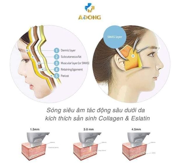 Máy Hifu đem lại nhiều công dụng làm đẹp - Thẩm mỹ Á Đông