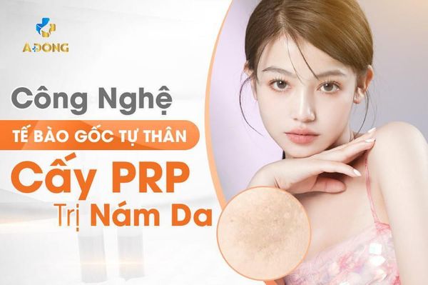Các phương pháp trị nám được ưa chuộng tại Thẩm mỹ Á Đông