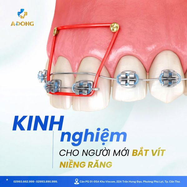 🦷 KINH NGHIỆM DÀNH CHO NGƯỜI MỚI BẮT VÍT NIỀNG RĂNG🦷