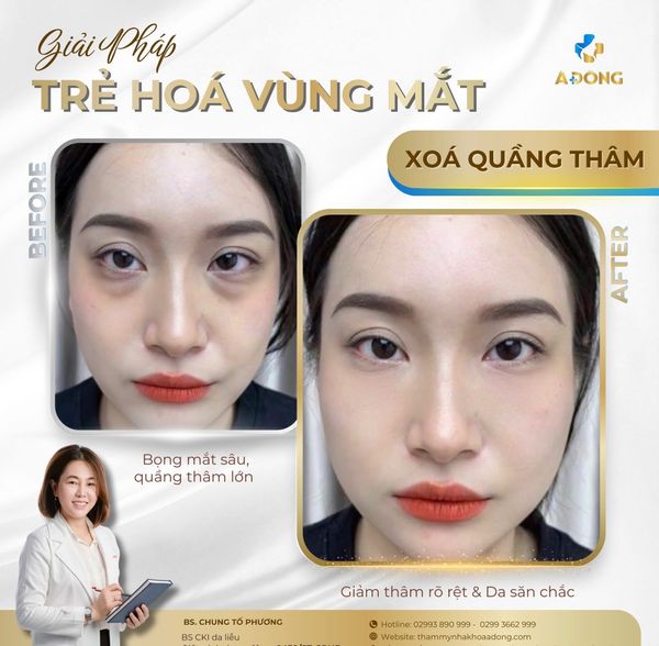 👁 Đôi mắt không chỉ mệt – mà đang kêu cứu