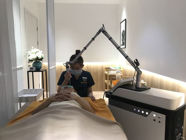 Laser trị nám – Giải pháp toàn diện cho làn da đẹp như mơ
