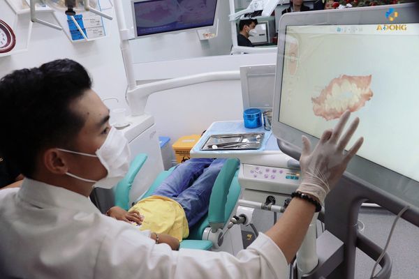 Bôi SDF – Giải pháp ngừa sâu răng an toàn cho trẻ em