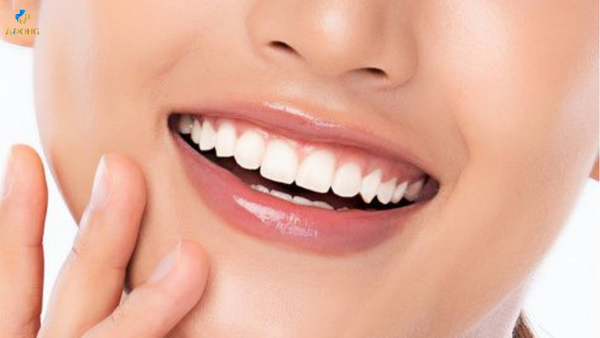 Niềng răng có hết lệch mặt không? Nên chọn phương pháp nào?