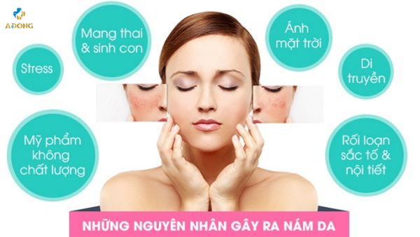 Cách trị nám tại nhà bằng thực phẩm giàu dưỡng chất