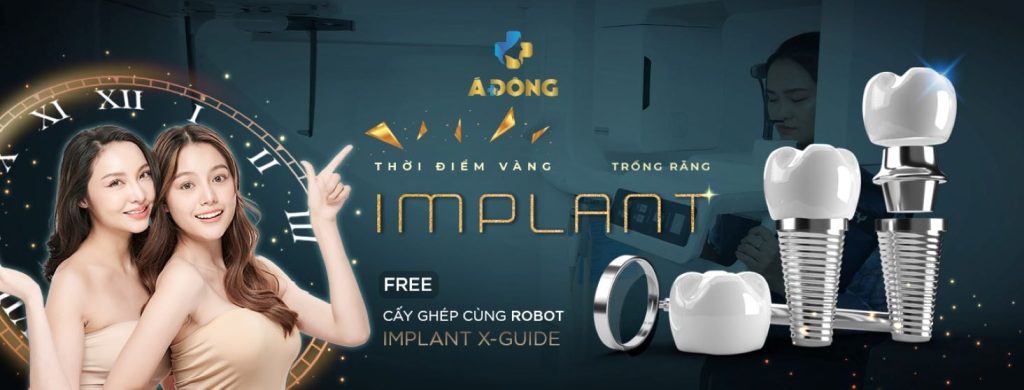 Trồng Implant