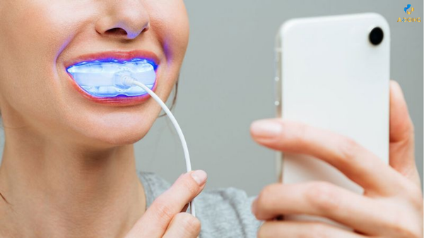 Lợi ích của việc tẩy trắng răng tại Nha Khoa không thể bỏ qua