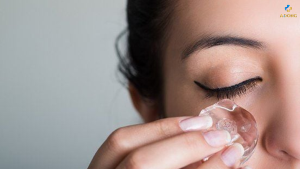 Hiệu quả không thể ngờ đến khi điều trị mụn bằng đá lạnh