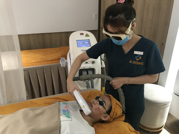 Trị Nám Hiệu Quả Tại Thẩm Mỹ Viện Á Đông hiệu quả nhờ vào công nghệ laser