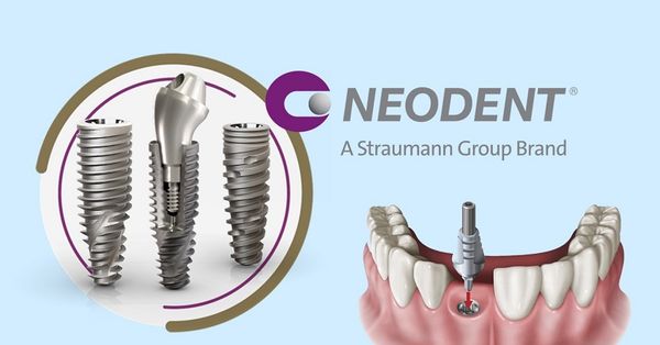 Các loại implant phổ biến - Nha khoa Á Đông