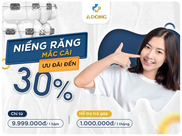 Niềng Răng Mắc Cài Giảm Giá Chỉ Còn 9.999.000đ / 1 Hàm